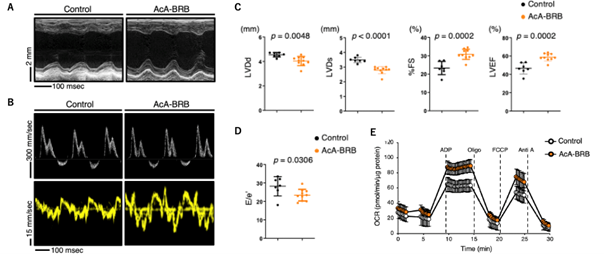図3　改良型マイトルビンによる老齢マウスの心機能とミトコンドリア機能の改善