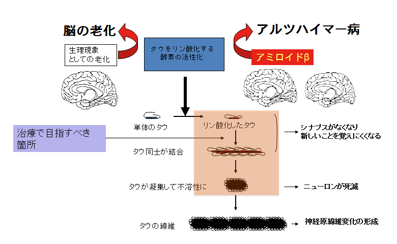 図　アルツハイマー病の治療で目指すべき箇所